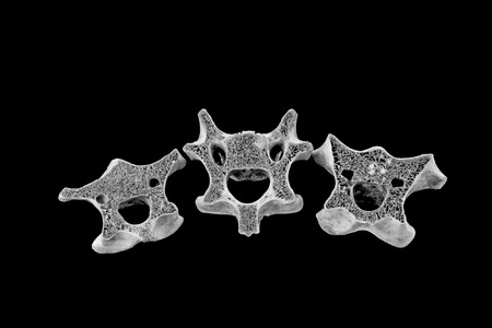 Bones in a black background, closeup of photoの写真素材