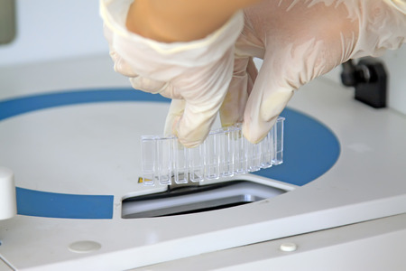 biochemical analyzer test in centers for disease control