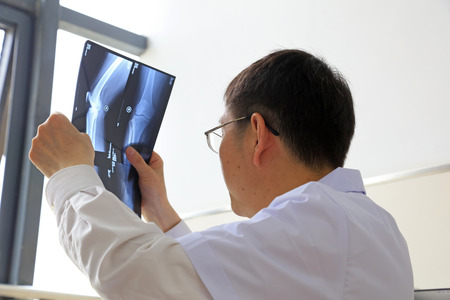 Luannan County - May 21, 2016: doctor looking at X - ray, Luannan, Hebei, Chinaのeditorial素材