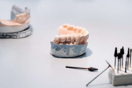 Model of teeth made of plaster of the jaw for dental technicians
