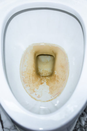 dirty toilet bowl, dirty toilet bowl, dirty toilet bowl, dirty toilet bowl