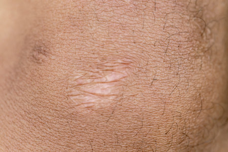 close up of dry skin on a man's body, as background