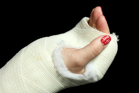 Details of an arm cast isolated on black background.の写真素材