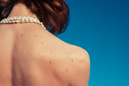 A young woman is tanning her back on a sunny day with a clear blue skyの写真素材