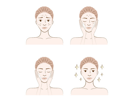A woman illustration made facial treatment acne skin problemのイラスト素材