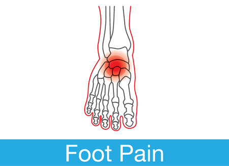 Outline of foot and bone which have pain on top of foot. This is medical illustration.のイラスト素材