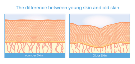 The difference between young skin and old skin. This illustration about skincare.のイラスト素材