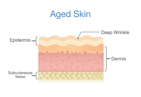 Aged skin layer in 3D vector style. Illustration about health care and beauty.のイラスト素材