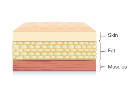 Anatomy of Skin layer, fat cell and muscle layer in vector style. Illustration about medical and health.のイラスト素材