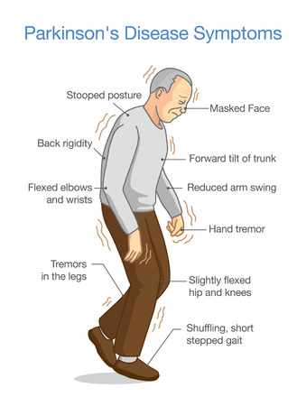 Parkinson's Disease Symptoms. Illustration about health problem of elderly people.のイラスト素材