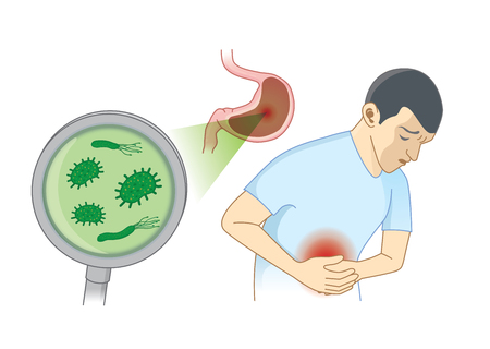 Man Suffering from stomach ache symptom because bacterial. Concept Illustration about hygiene and health.のイラスト素材