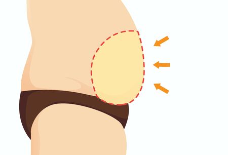 Big belly of fat people and focus on bulging stomach with Dotted line. Illustration about weight and health problem.のイラスト素材