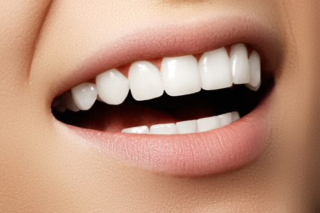 Beautiful wide smile of young fresh woman with great healthy white teeth. Closeup of woman smiling with prefect white teethの写真素材