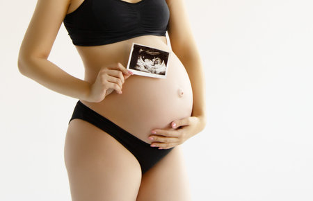 Prenatal ultrasound screening. Beauty pregnant holding sonogram picture of unborn baby inside her...