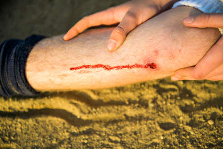 The pre-teen child was injured in baseball sport