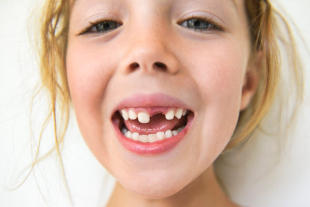 Smiling little girl missing tooth on white background
