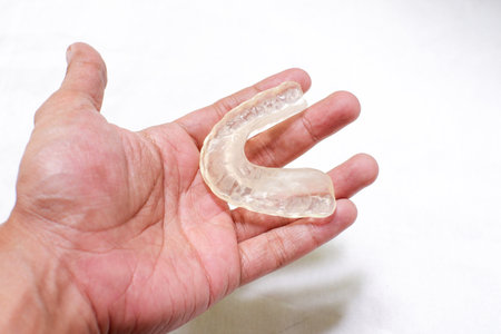 splintÂ therapy are to eliminateÂ TMJÂ and muscle pain, to improve jaw function, and to recapture the displaced discの写真素材