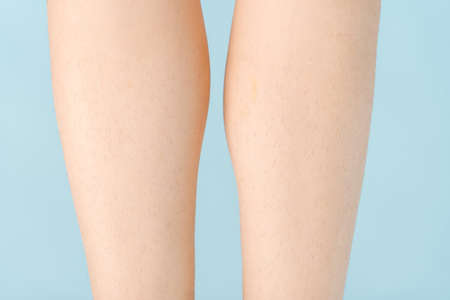 Women's legs with a lot of hair before epilation, close-up