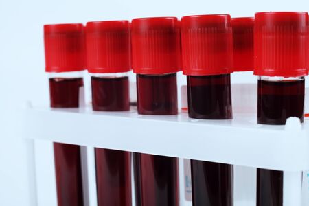 medical blood tubes on a tripod, macro, soft focus, tinted in blueの写真素材