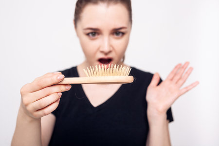 Shocked woman holds hairbrush with fallen hair. Hair loss concept.の写真素材