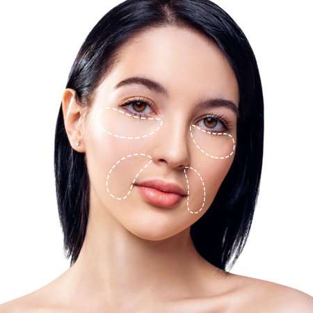 Female face with dotted area under eyes and near mouth. Plastic surgery anti-age concept.