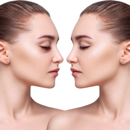 Sensual woman with bruises under eyes before and after treatment. Over white background.の写真素材