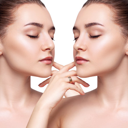 Comparative portrait of female nose before and after plastic surgery.の写真素材