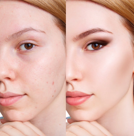 Female face with imperfections before and after applying makeup step by step.の写真素材