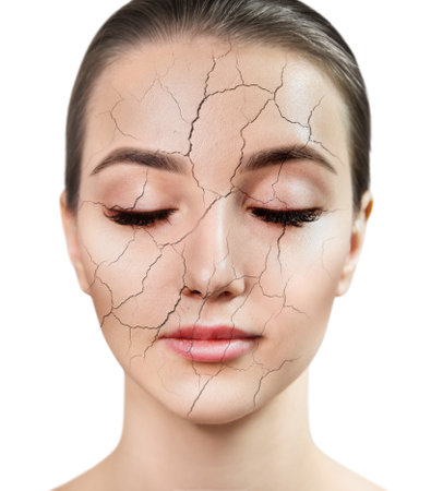 Sensual woman with cracked facial skin. Dry facial skin concept. isolated on white background.の写真素材