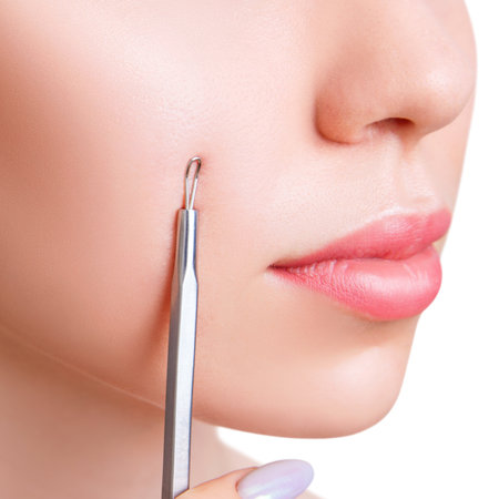 Young woman with acne loop. Squeeze the acne with acne spoon. isolated on white.の写真素材