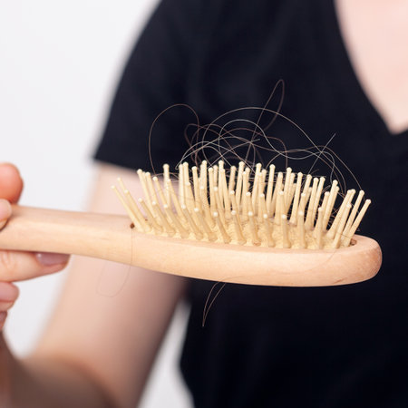 Female hand holds hairbrush with fallen hair. Hair loss concept.の写真素材