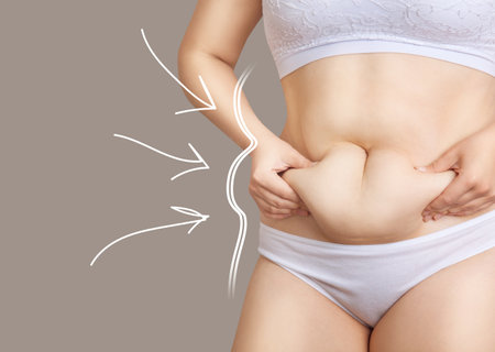 White outlines with arrows around fat body of young unrecognizable woman. Liposuction concept.の写真素材