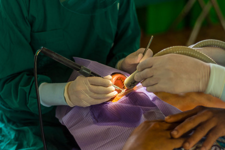Dentist and dental assistant calculus removing. Dental Scaling.の写真素材