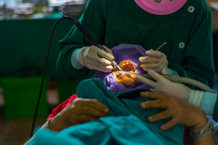 Dentist and dental assistant calculus removing. Dental Scaling.の写真素材