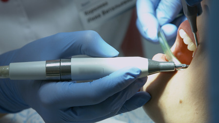 Patient for preventive medical checkup at dentist with probe and mirrorの写真素材