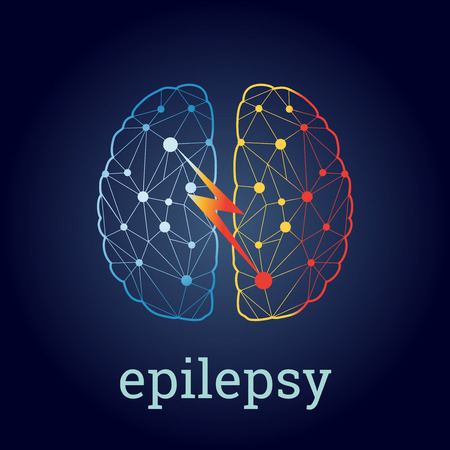 brain illustration with strong epileptic activityのイラスト素材