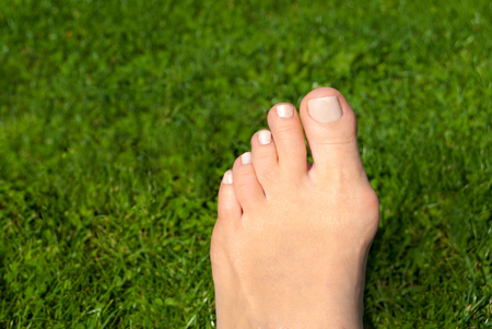 Hallux valgus, bunion in woman foot on grass backgroundの写真素材