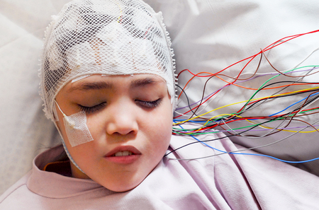 Girl with EEG electrodes attached to her head for medical testの写真素材