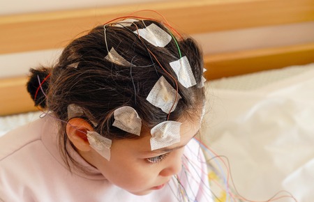 Girl with EEG electrodes attached to her head for medical testの写真素材