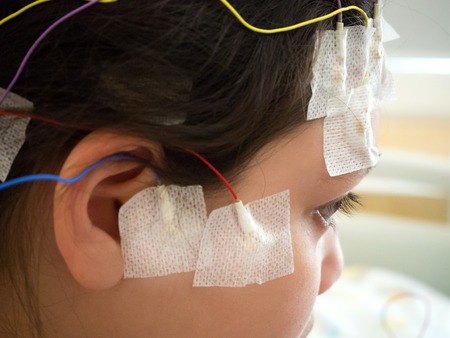 Girl with EEG electrodes attached to her head for medical testの写真素材