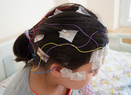 Girl with EEG electrodes attached to her head for medical testの写真素材