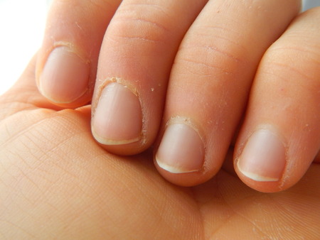 a detail of a hand fingers and nails