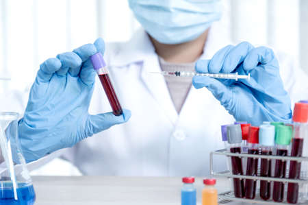 doctor's hand holding a sample blood tube for analysis and test virus disease in the laboratory,...