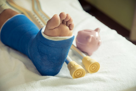 Man's leg uses crutches to walk after surgery recovery injury broken bones with pink piggy bank.の写真素材