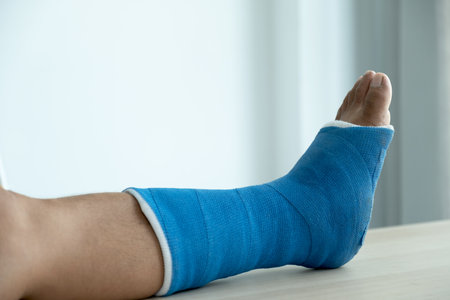 Man's leg uses crutches to walk after surgery recovery injury broken bones.の写真素材