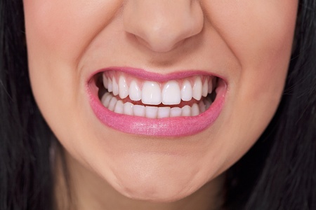 Close up of female perfectly white healthy teeth in angry grinの写真素材