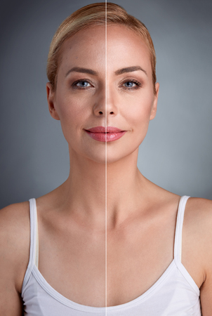 portrait of middle age woman with part of perfect skin and part with unperfected skin