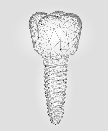 Molar tooth dental implant 3d low poly geometric model. Dentistry innovation future technology titan metal thread. Medical science abstract gray white polygonal point line vector illustration artのイラスト素材