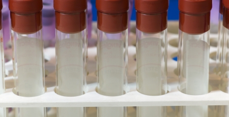 Close up of some test tubes with red plugs for blood samples on a rack  の写真素材