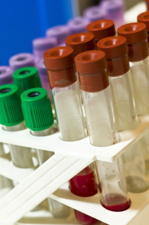 Close up of some test tubes with red, mauve and green plugs for blood samples on a rack  Some drops of blood inside two tubesの写真素材